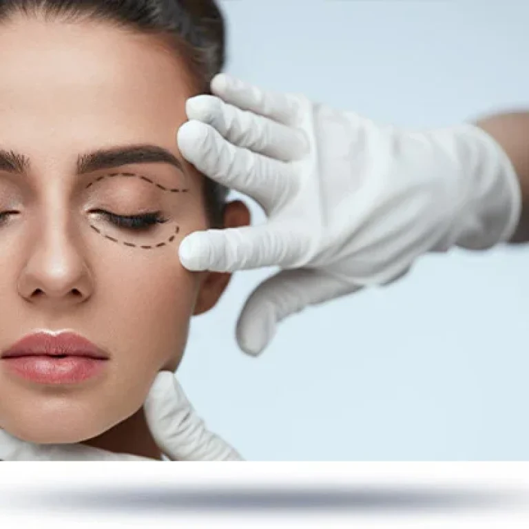 01-blepharoplasty